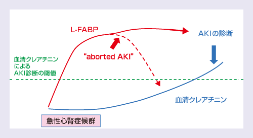 図2　バイオマーカーによる早期診断でAKIの‘abort’を目指す