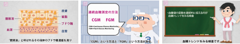 4-7-A　血糖トレンドを知る方法〜 SMBG、CGM、FGM