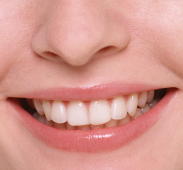 歯周病予防のために3つのチェックポイント　歯科医師が解説