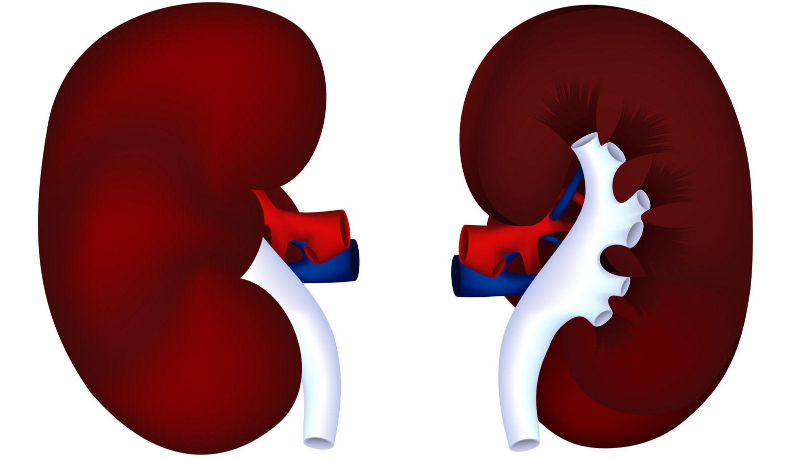 高尿酸血症が腎臓の機能障害の原因に　少しの異常でも腎臓に悪影響