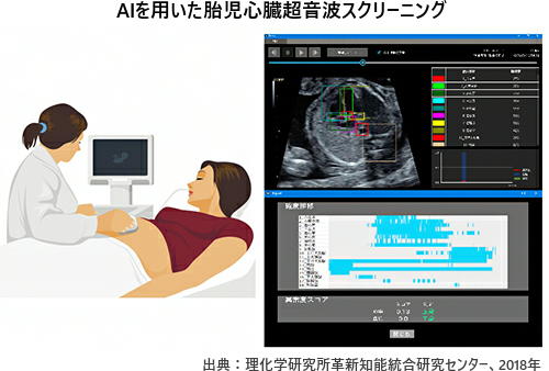 AIを用いた胎児心臓超音波スクリーニング