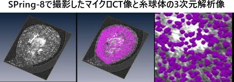 SPring-8で撮影したマイクロCT像と糸球体の3次元解析像