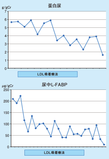 図4 LDL吸着療法の治療経過 －蛋白尿と尿中L-FABP－