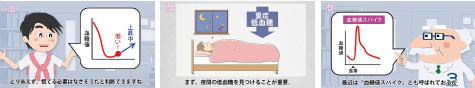 4-7-B 血糖トレンドを治療に生かす