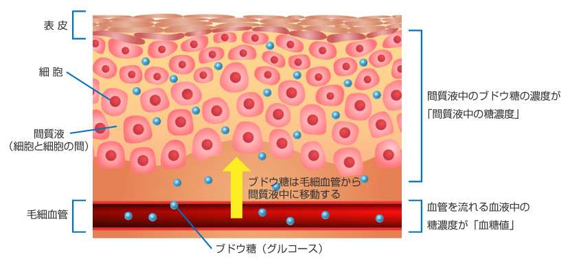 「血糖値」と「間質液中の糖濃度」の違い（イメージ）